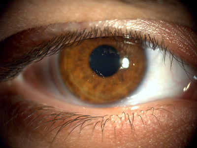 Jelly Bumps
Taken with a Topcon DC-1
Keywords: jelly bumps, contact lens