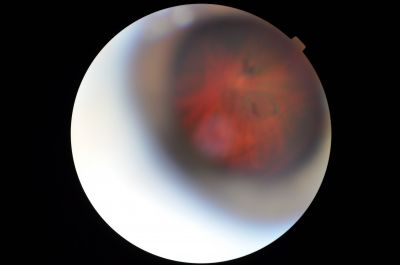 Operculum
Capture of operculum.
Keywords: operculum