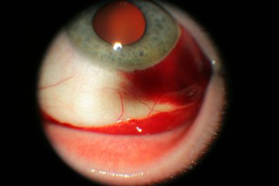 LE SCH
Nidek AFC-210
