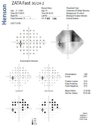 Anomalous field - good discussion case
